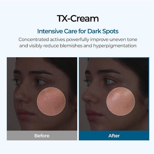 Tranexamic Acid + Niacinamide Cream