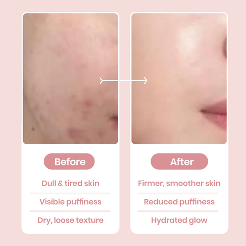 PDRN Collagen Caffeine Wrapping Mask